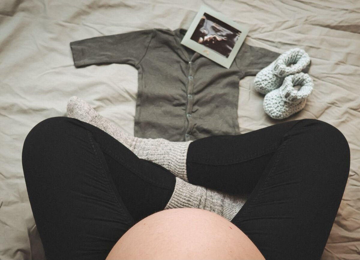Een creatieve zwangerschapsfoto met een truitje, babyschoentjes en een echo op een bed.