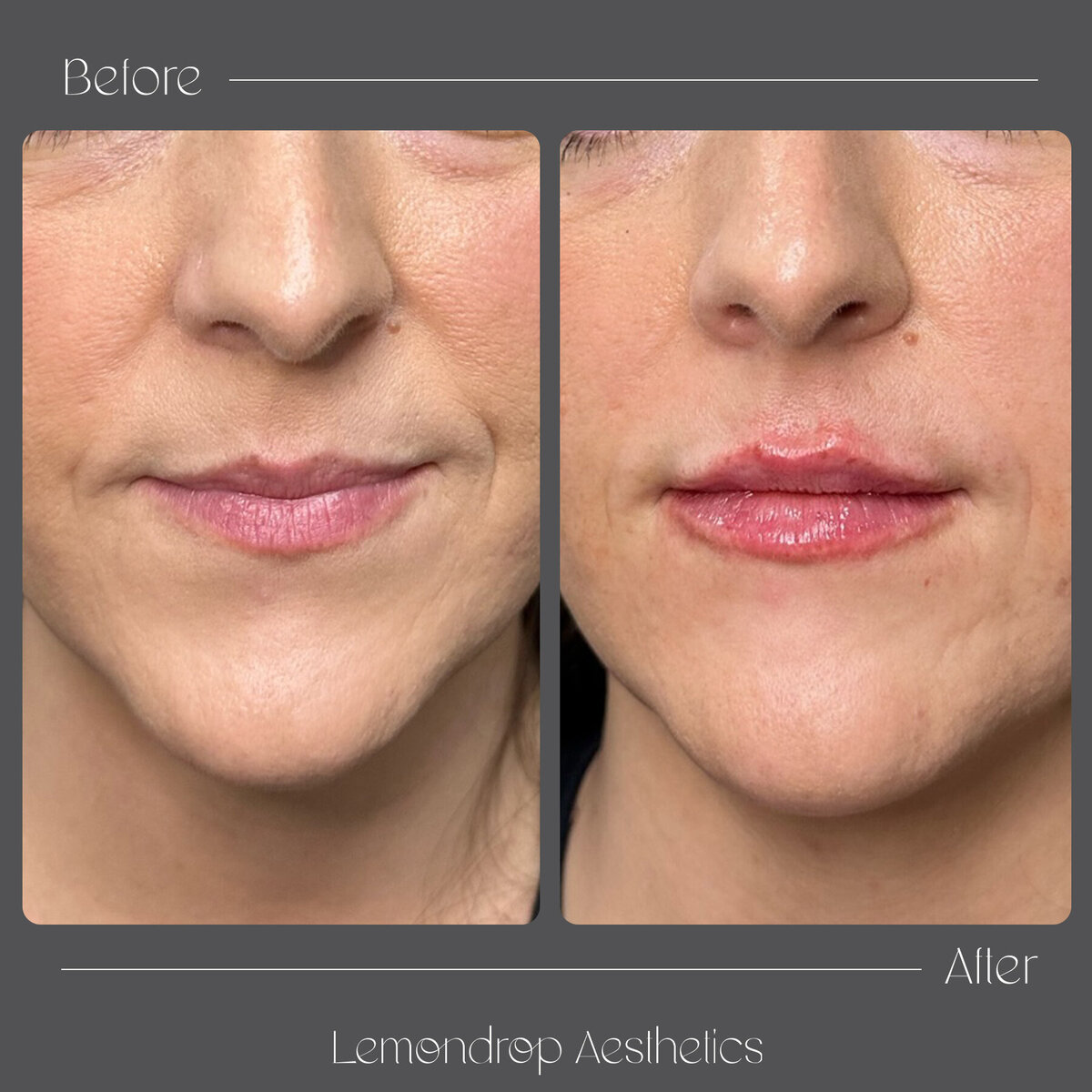 BEFORE:AFTER VERTICAL copy 3