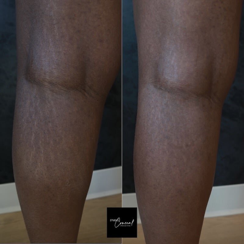 Black-skin-camouflage-3