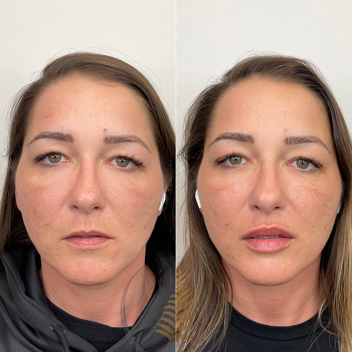 BEFORE:AFTER02 copy 14