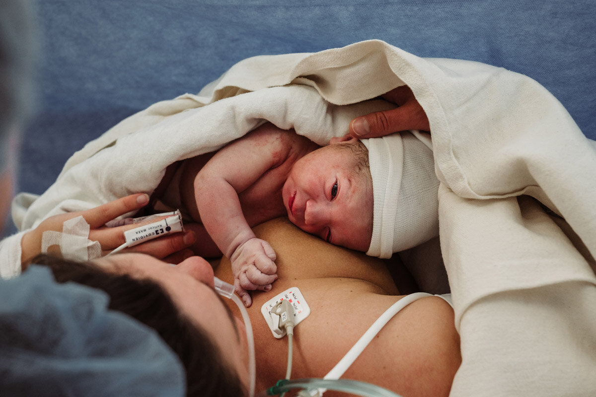 cesarean-birth-photography-natalie-broders-d-095