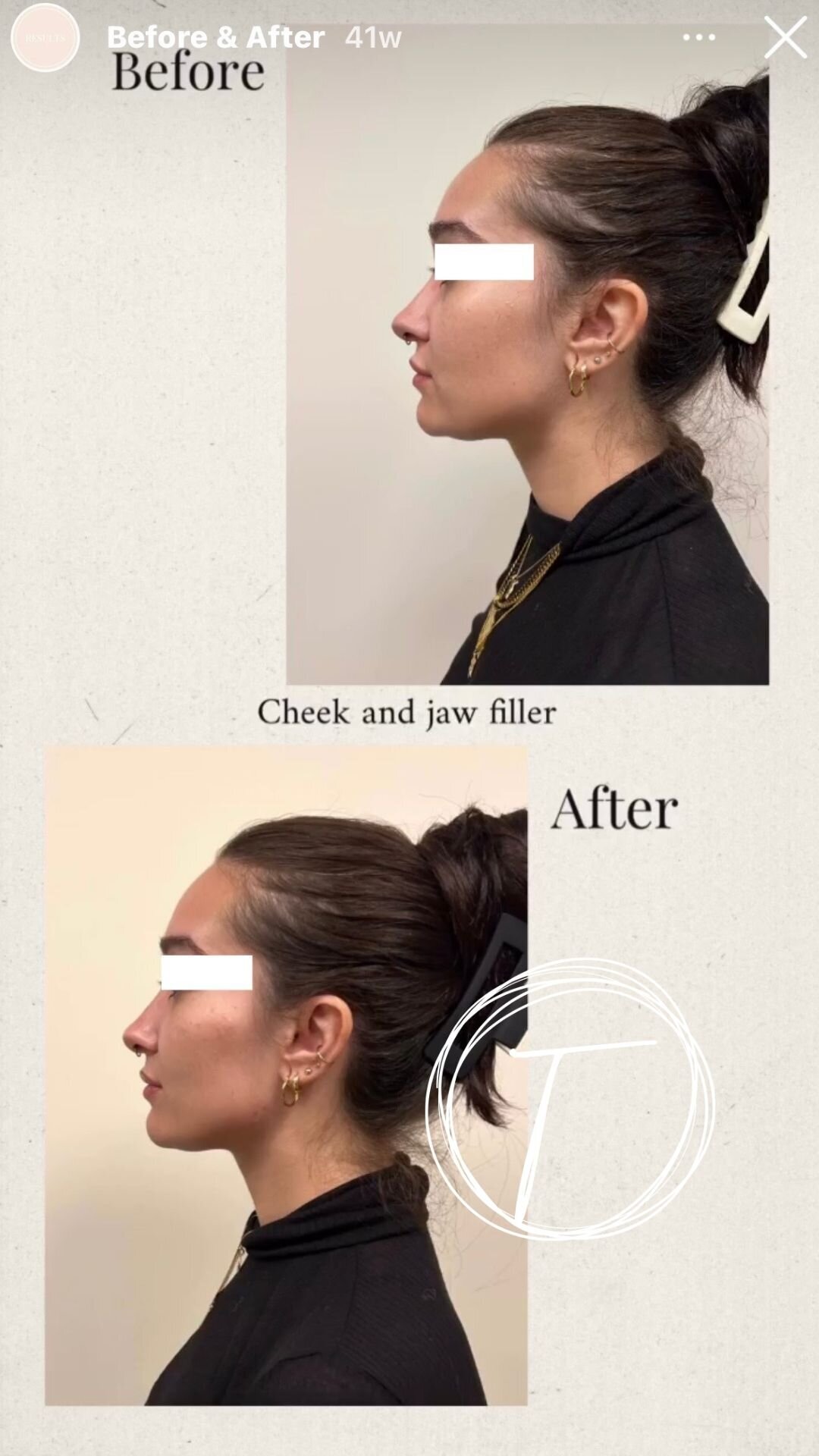 before:after results with look timeless - 15