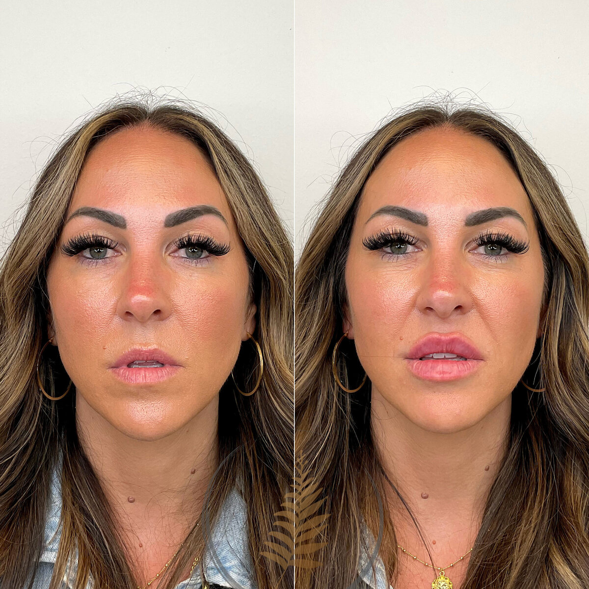FACESINBLOOM_BEFOREAFTER_LIPS_11