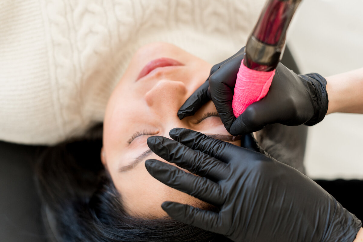 Ashley Turner removing permanent eyebrow makeup during a saline tattoo lightening procedure at Refresh Aesthetics
