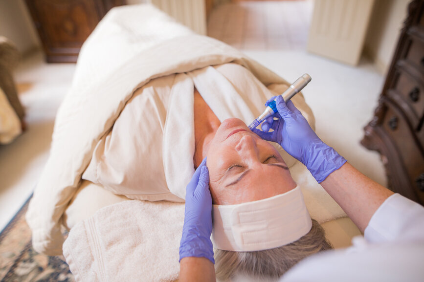Microneedling