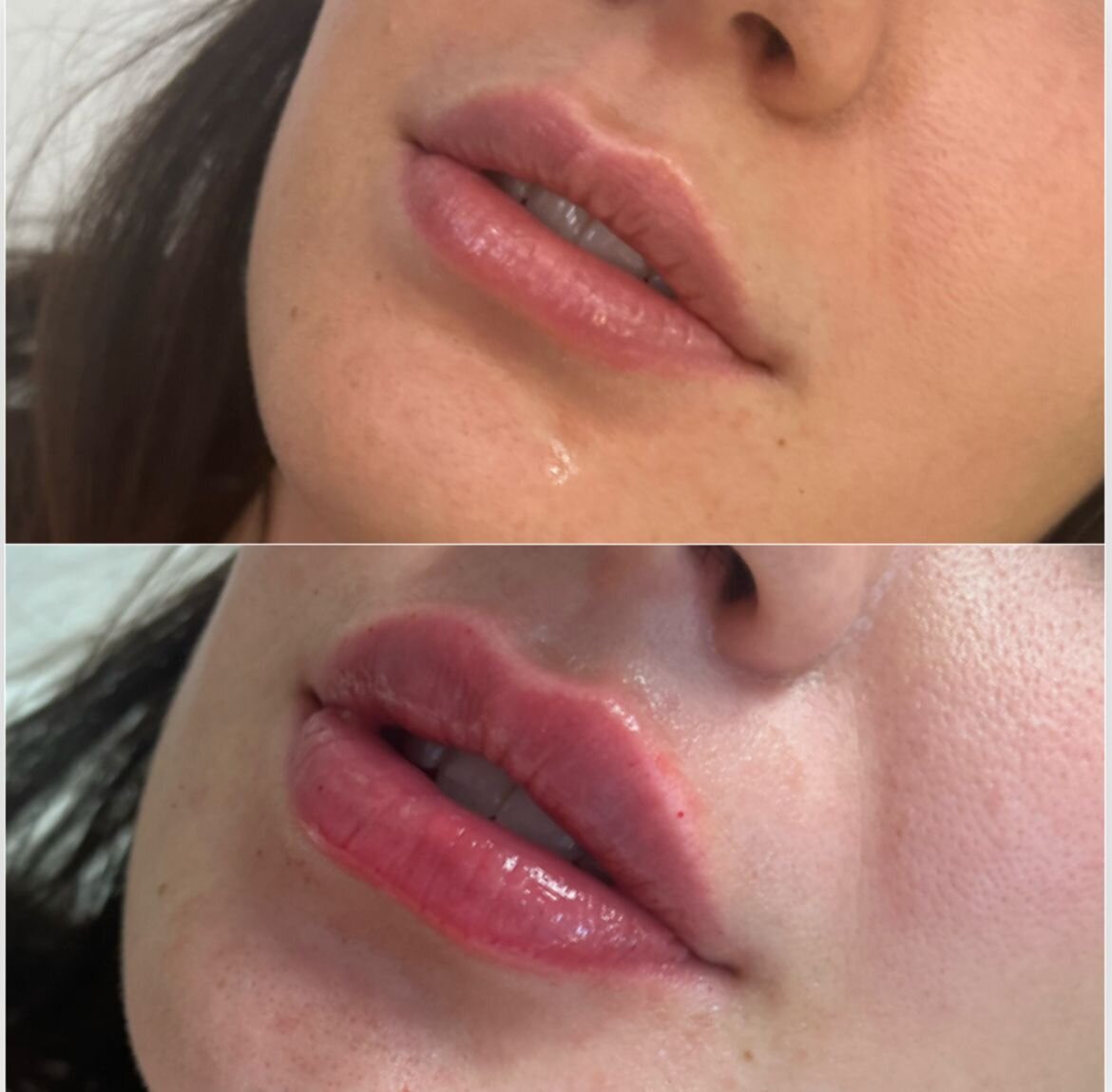 compressed-Lip-Wrinkles- Lip-volume-nd-some-brand-pics-15