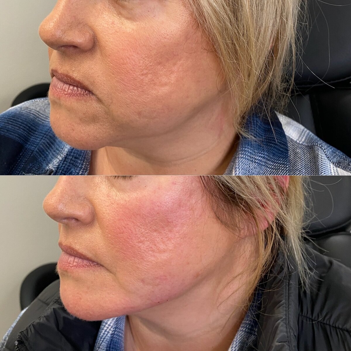 BalancedBeautyBotoxWestwood34
