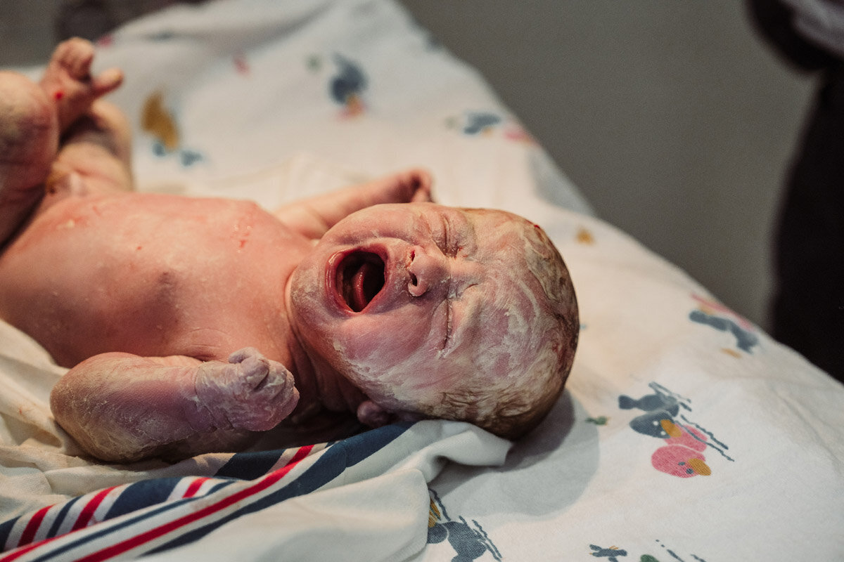 cesarean-birth-photography-natalie-broders-c-022