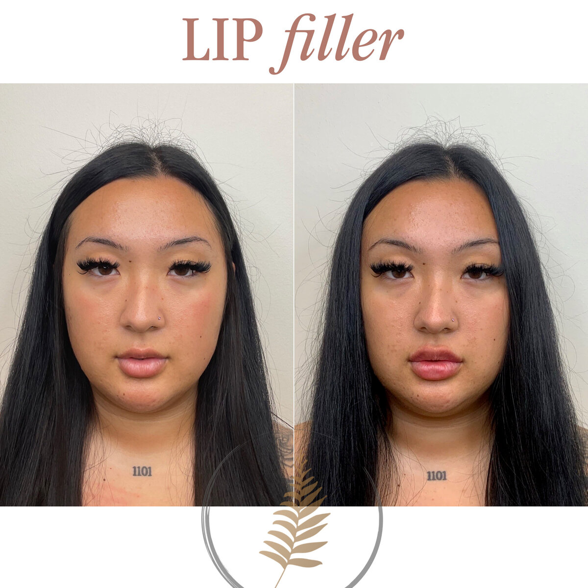 FIB BEFORE AND AFTER copy 7
