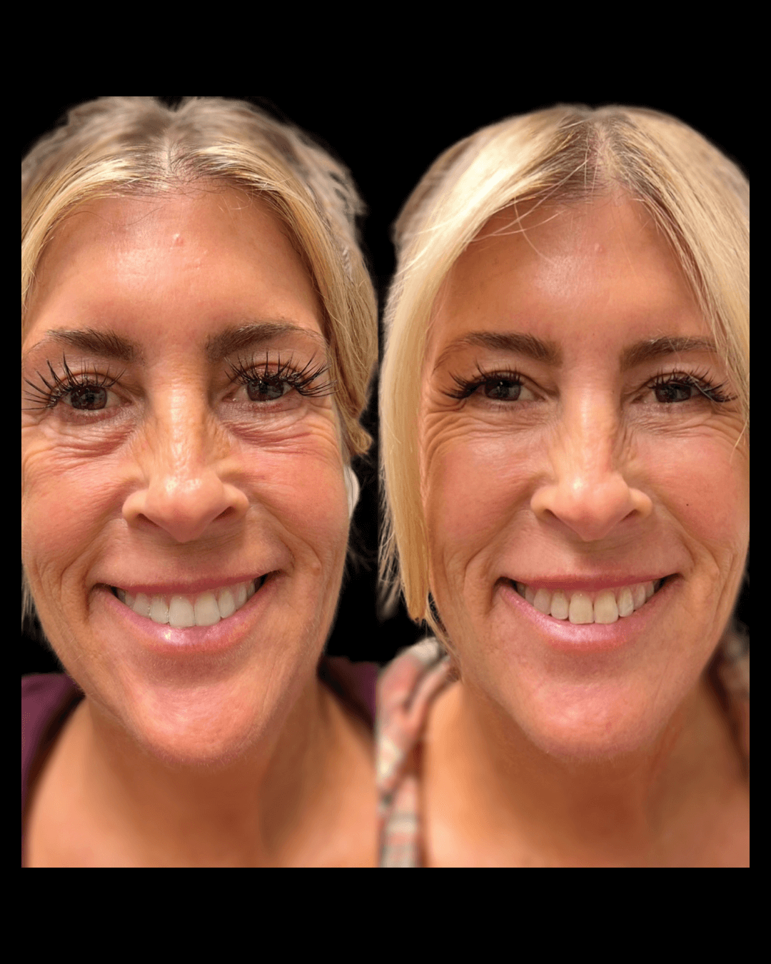 Maxwell-Aesthetics-Salem-Oregon-Results-9