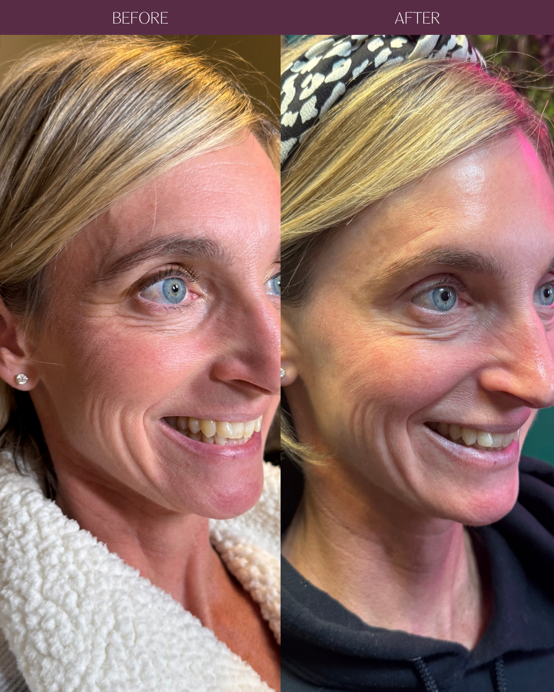 Copy of Before and Afters (Portrait Size).png 1