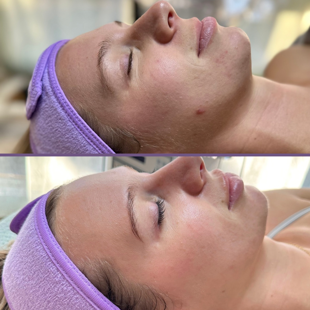 Nat B & A