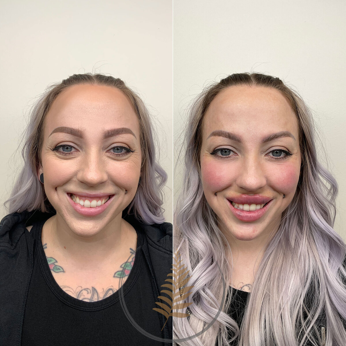 FACESINBLOOM_BEFOREAFTER_LIPS_02