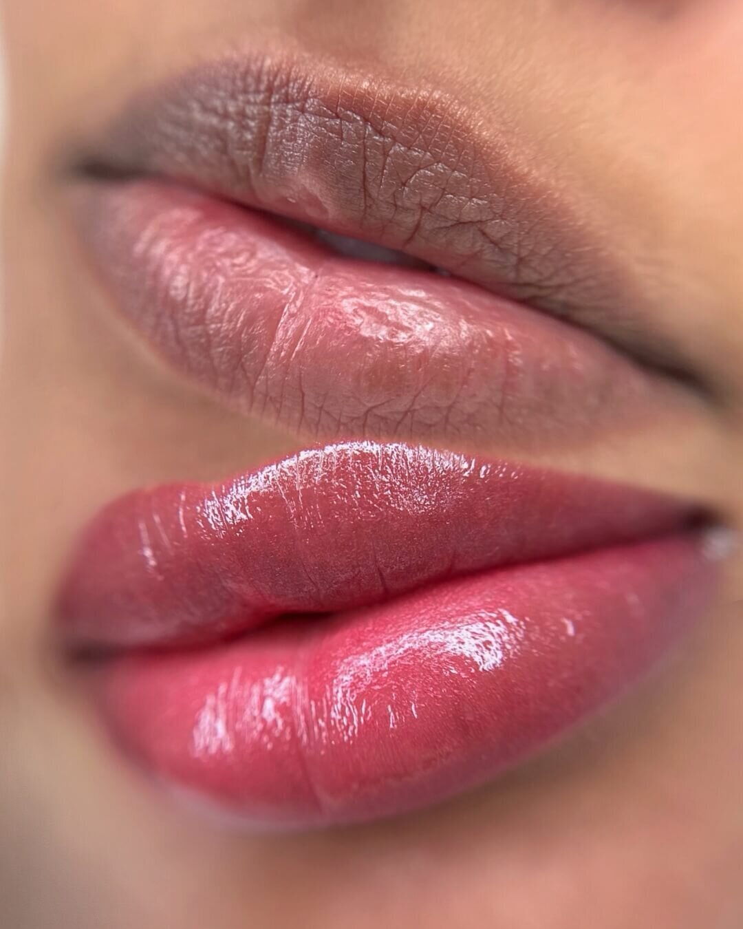 Dark Lip Neutralization Healing Your Comprehensive Guide