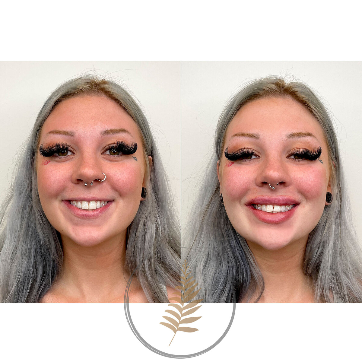 BEFORE-AFTER02 copy 8