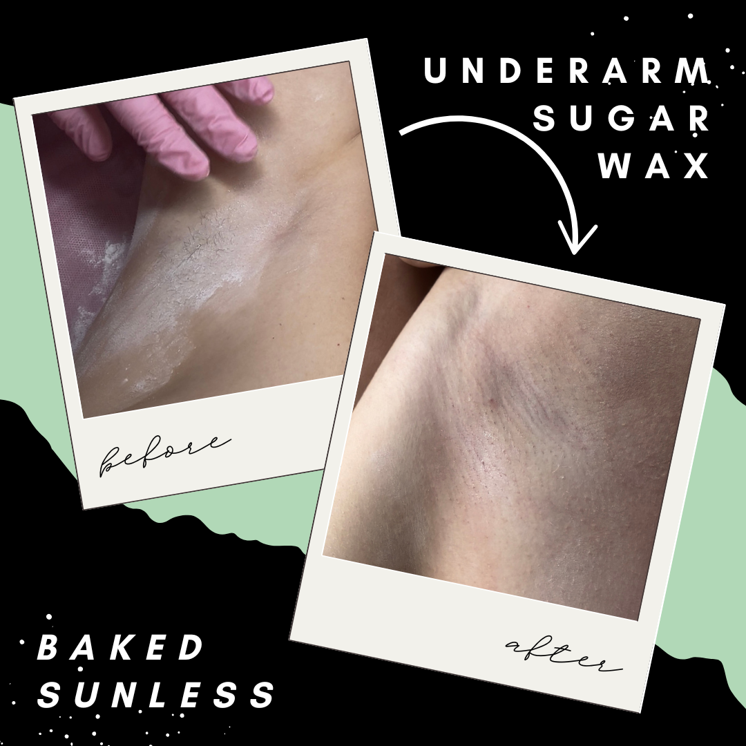 Baked Sunless Underarm Before and After