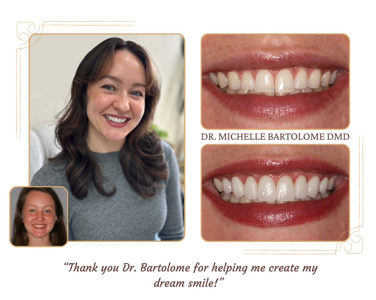 Smile Makeover (3)