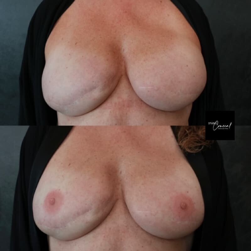 areola-3d-tattoo-az-2