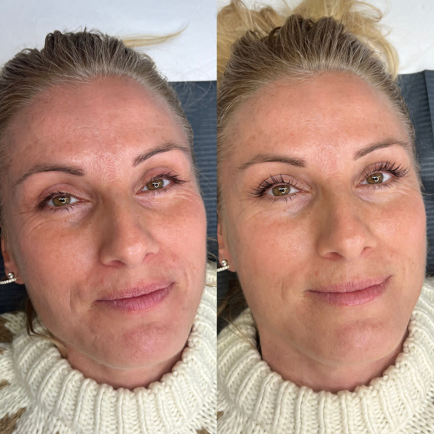before and after photos of woman with lash lift