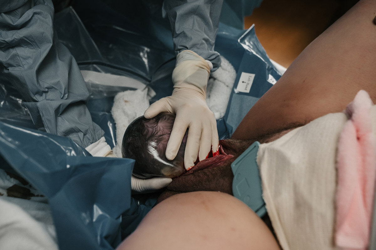 hospital-birth-photography-f-037