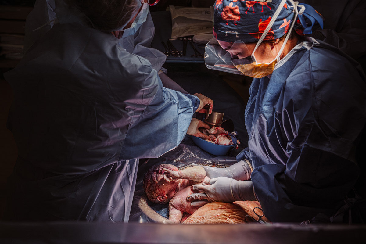 cesarean-birth-photography-natalie-broders-c-014