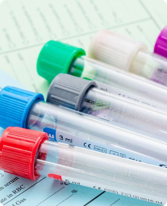 Comprehensive Lab Tests Gilbert AZ Lab Tests Near Me