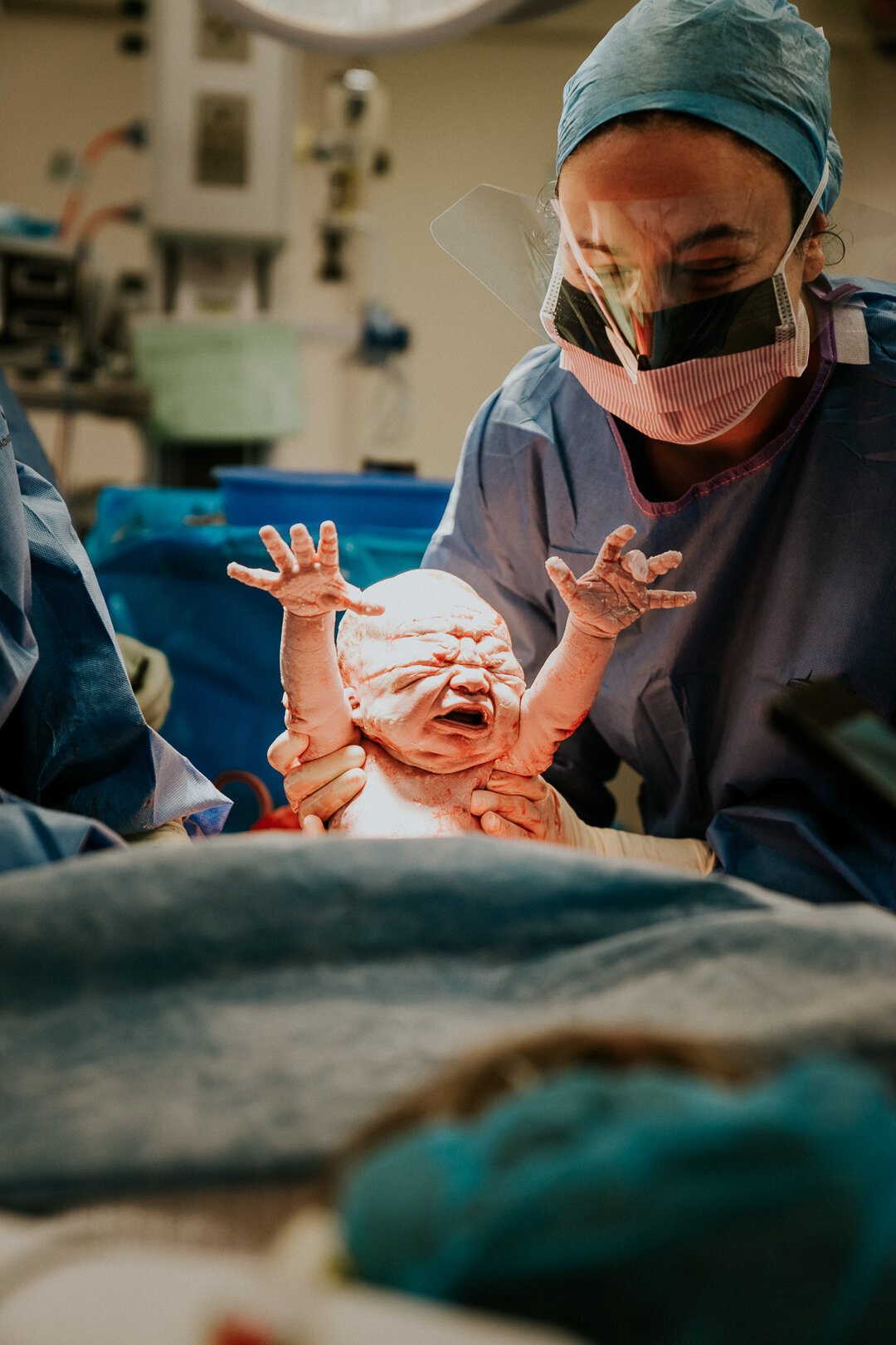 cesarian - c-section photography