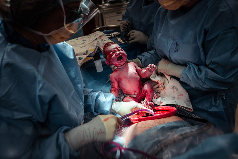 cesarean-birth-photograpy-portland-oregon-a-073