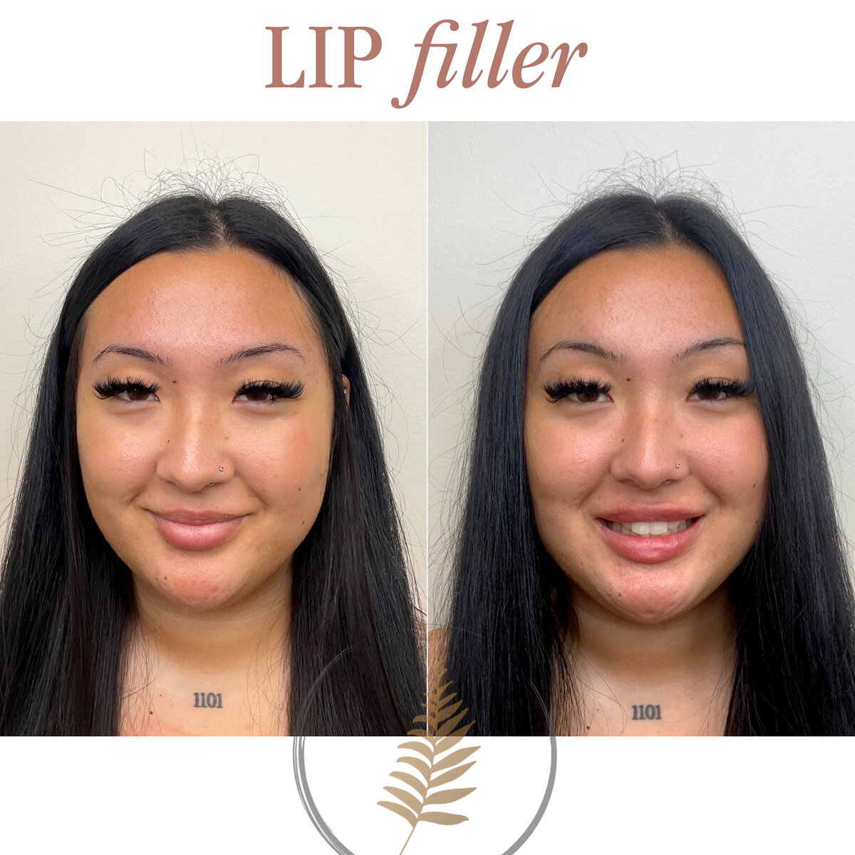 FIB BEFORE AND AFTER copy 4