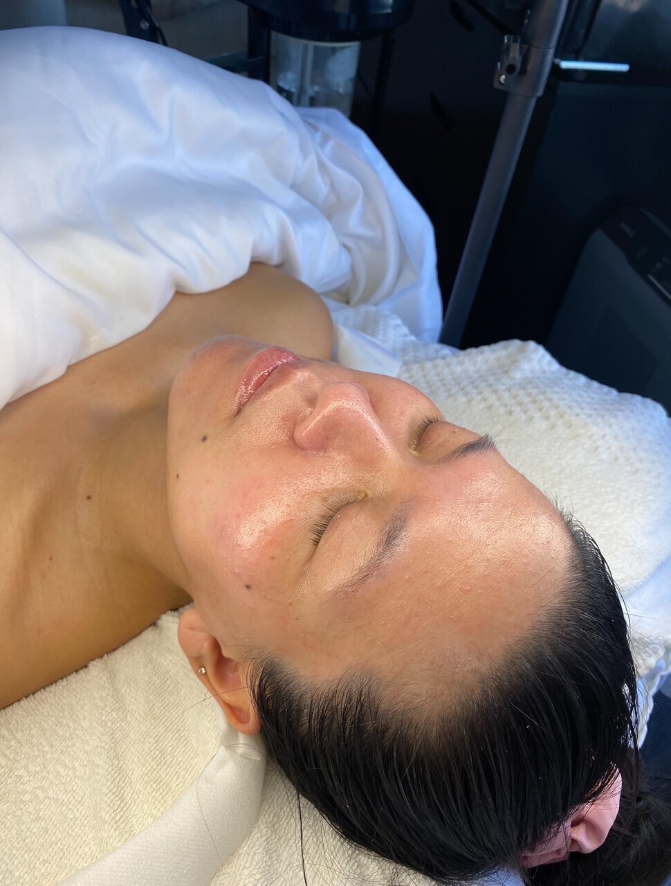 Facial 9