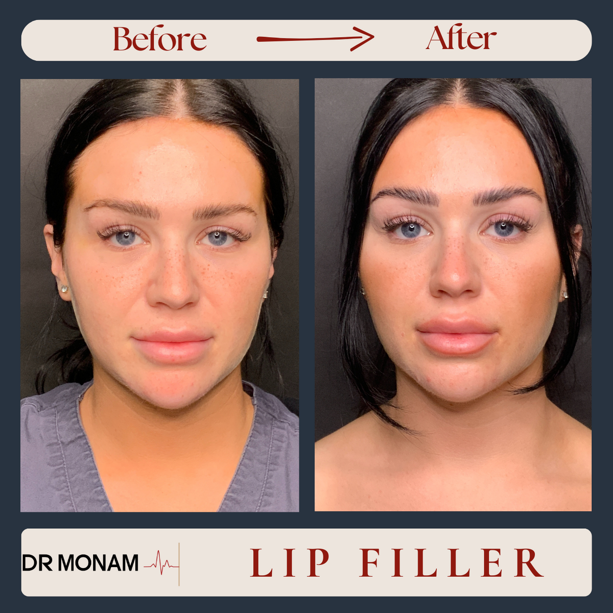 Neutral Before and After Instagram Post-11