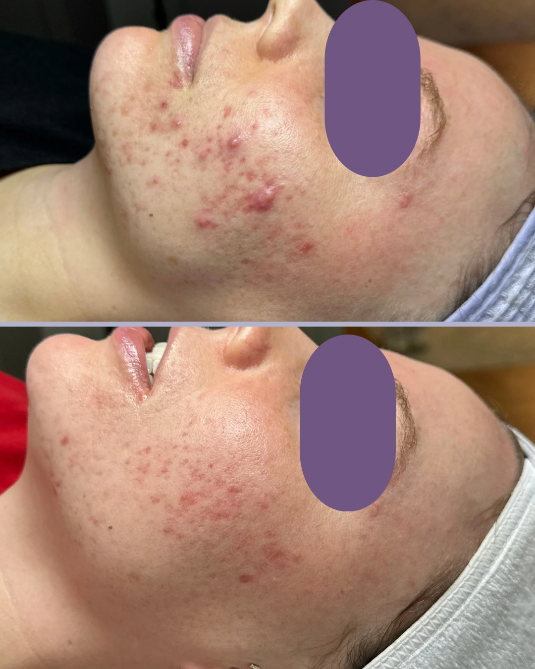Kendall B B&A (1)