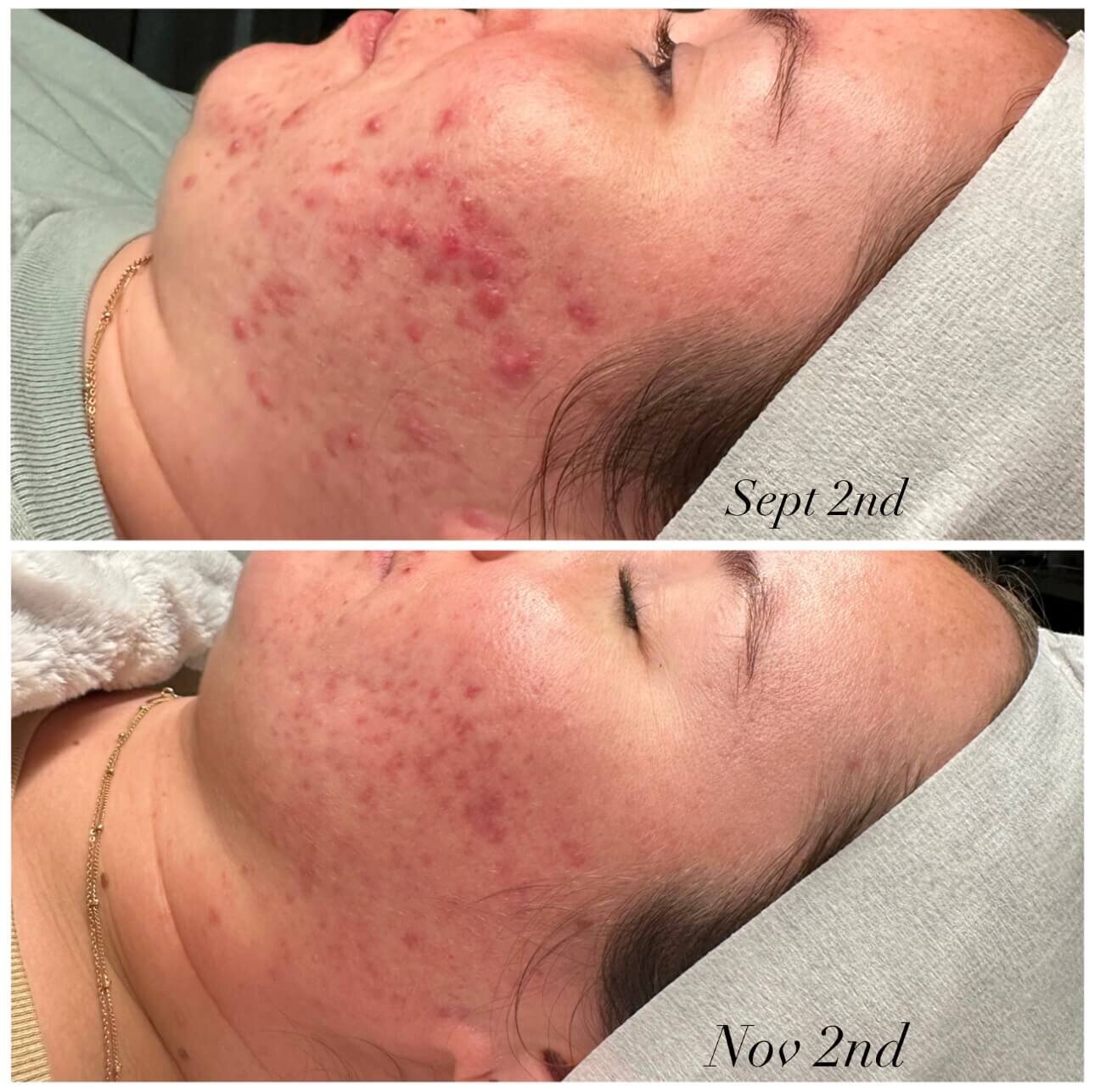 72E83D44-CF13-474E-AC1D-D4E0EDA5F89F