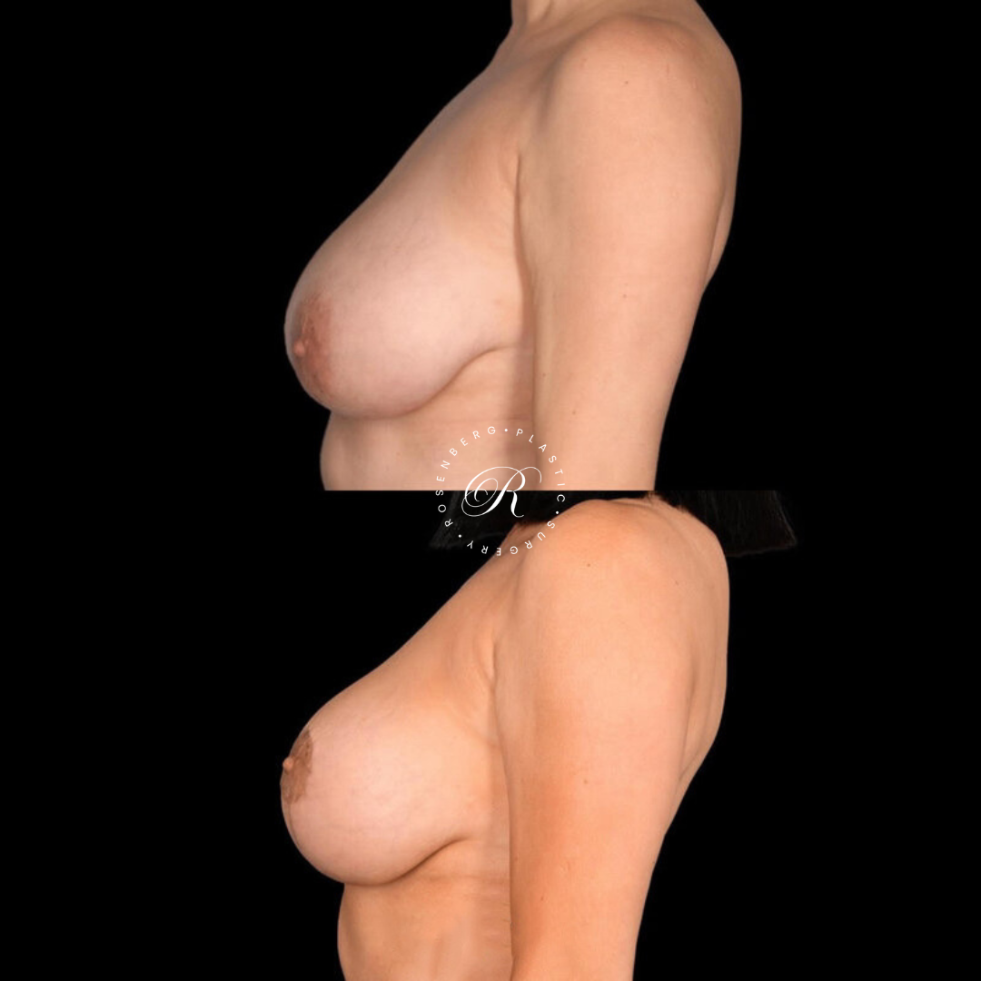 Copy of Template for Rosenberg Plastic Surgery B.zip - 18
