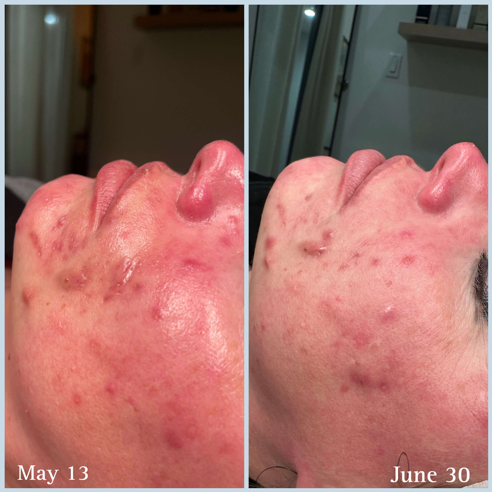 4E5DE245-F9AF-400A-9AAB-E7342E4AC61A