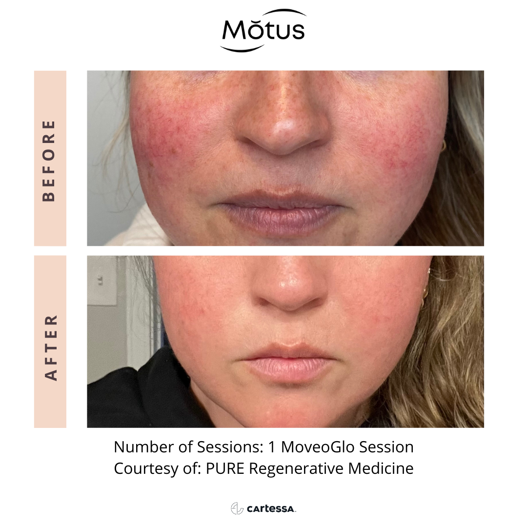 MotusAZ10168970926997