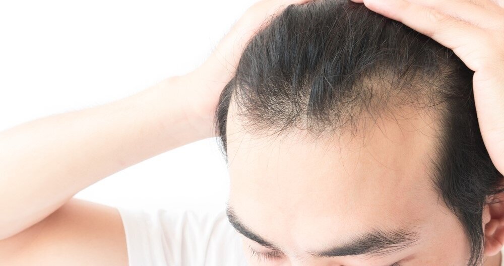 Anti-hair loss ultra skin clinic