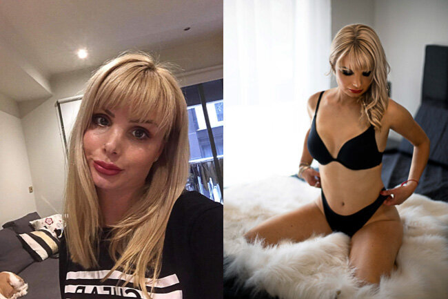 AMANDA BEFORE & AFTER MOBILE
