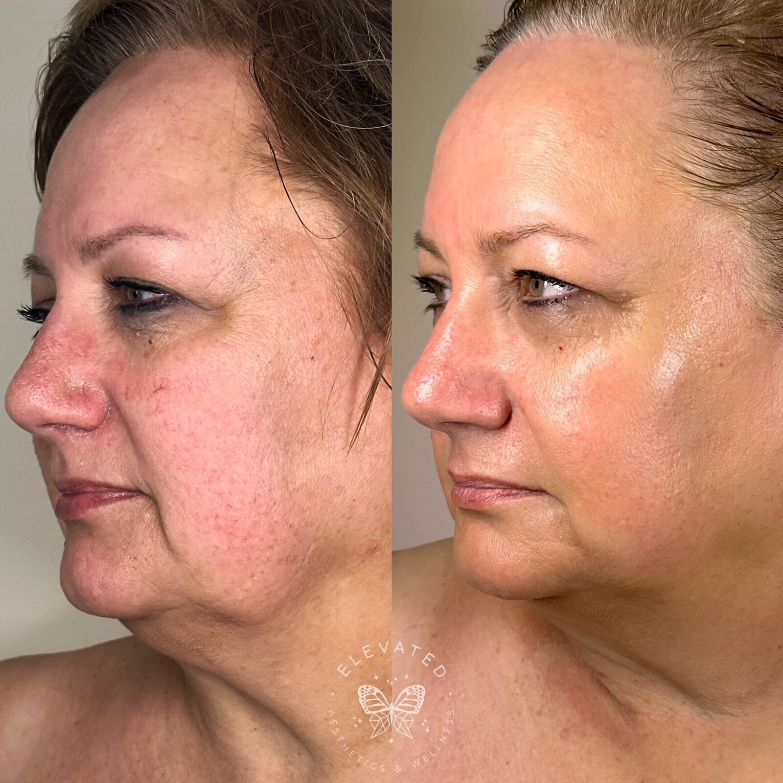 Facetune_15-06-2023-11-40-24