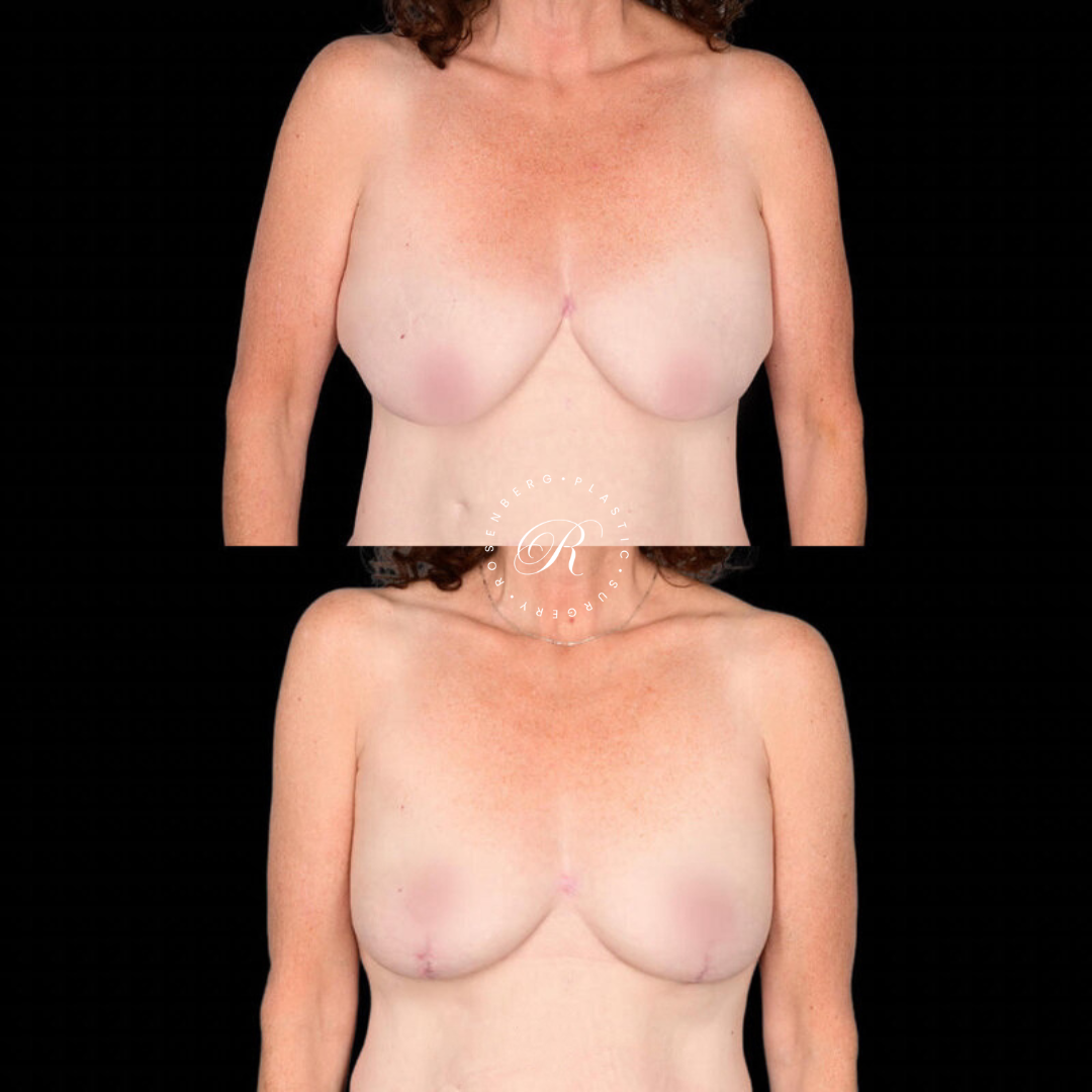 Copy of Template for Rosenberg Plastic Surgery B.zip - 10