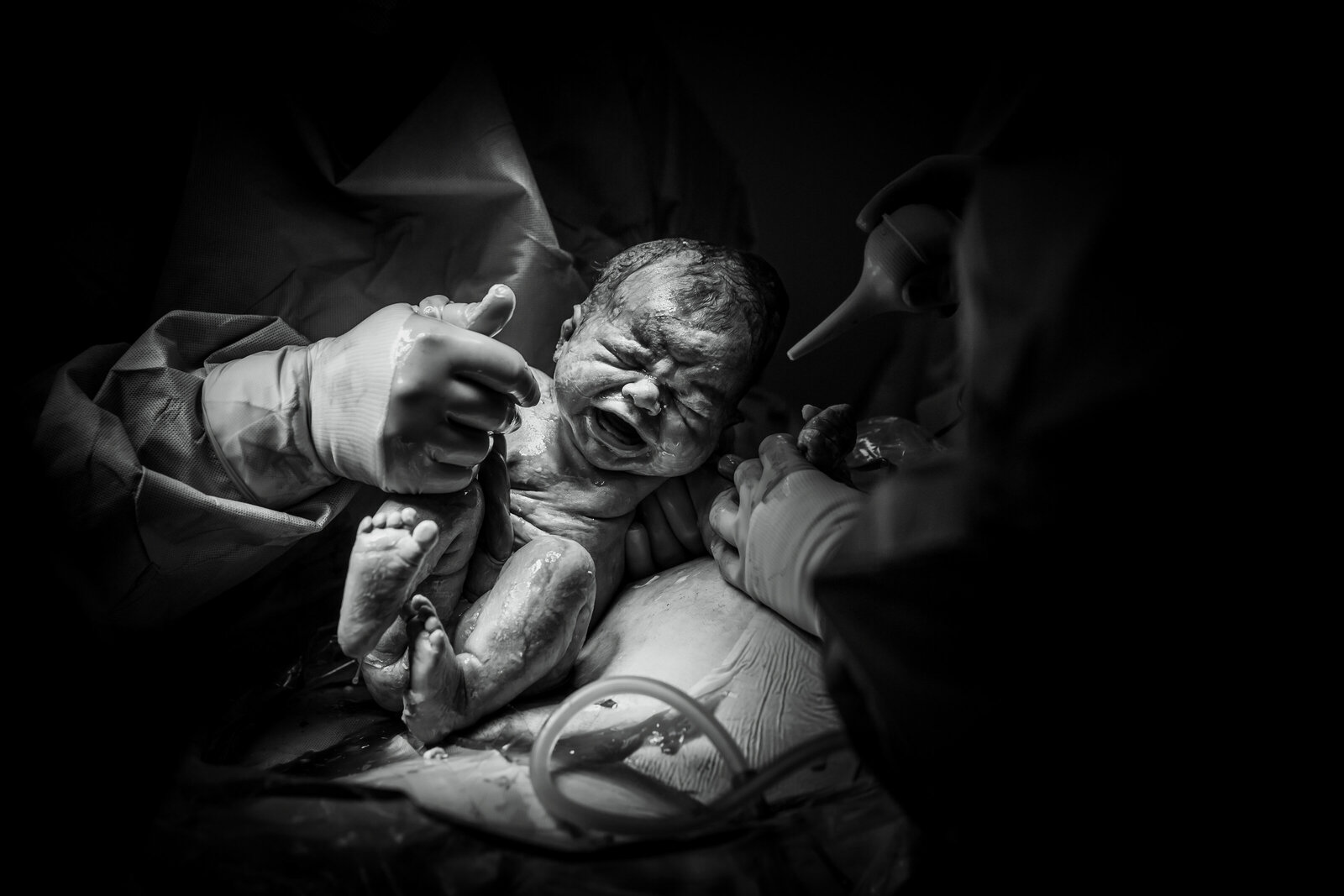 birth photographer, columbus, ga, atlanta, commercial photography, ker-fox photography, csection, cesarean_0949