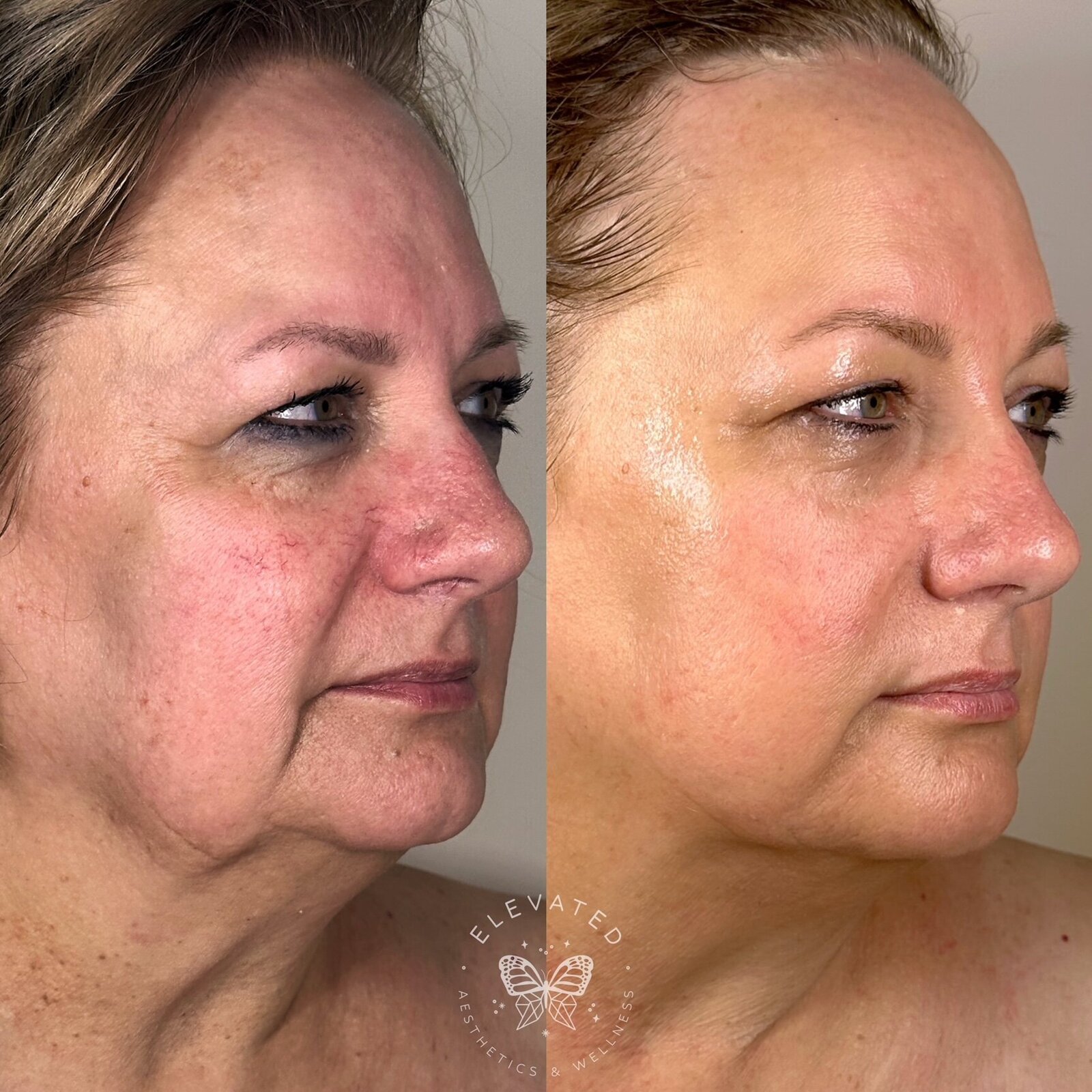 Facetune_15-06-2023-11-35-56
