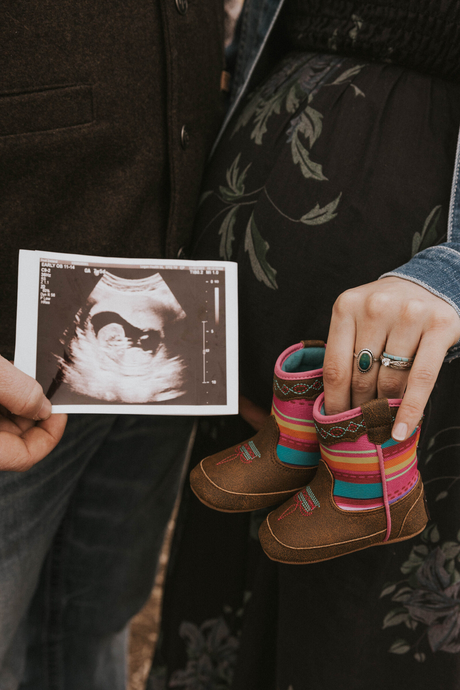 LINC+IRELANDMATERNITY_valenleephotography-20