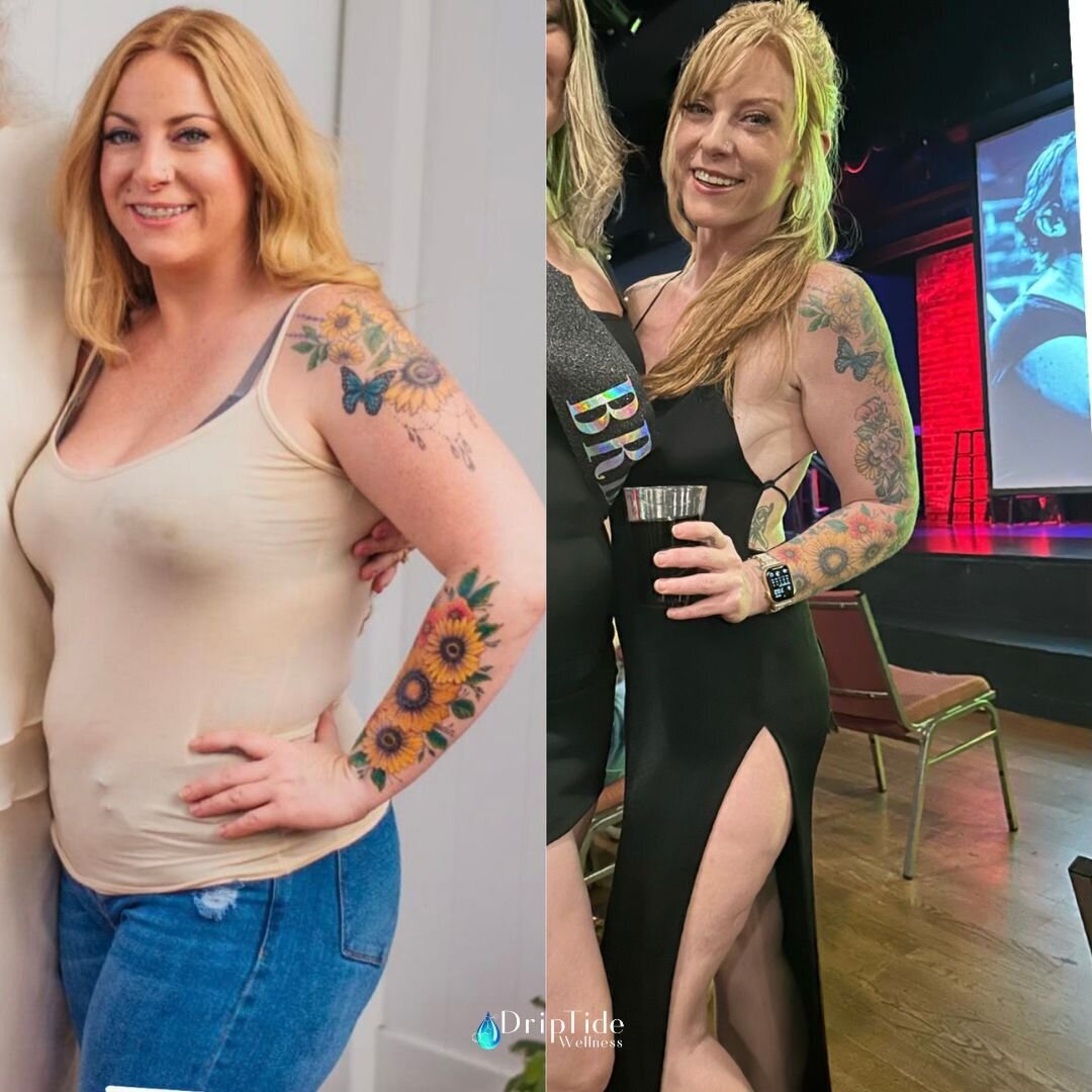 Transformation Tuesday - Lindsays patient