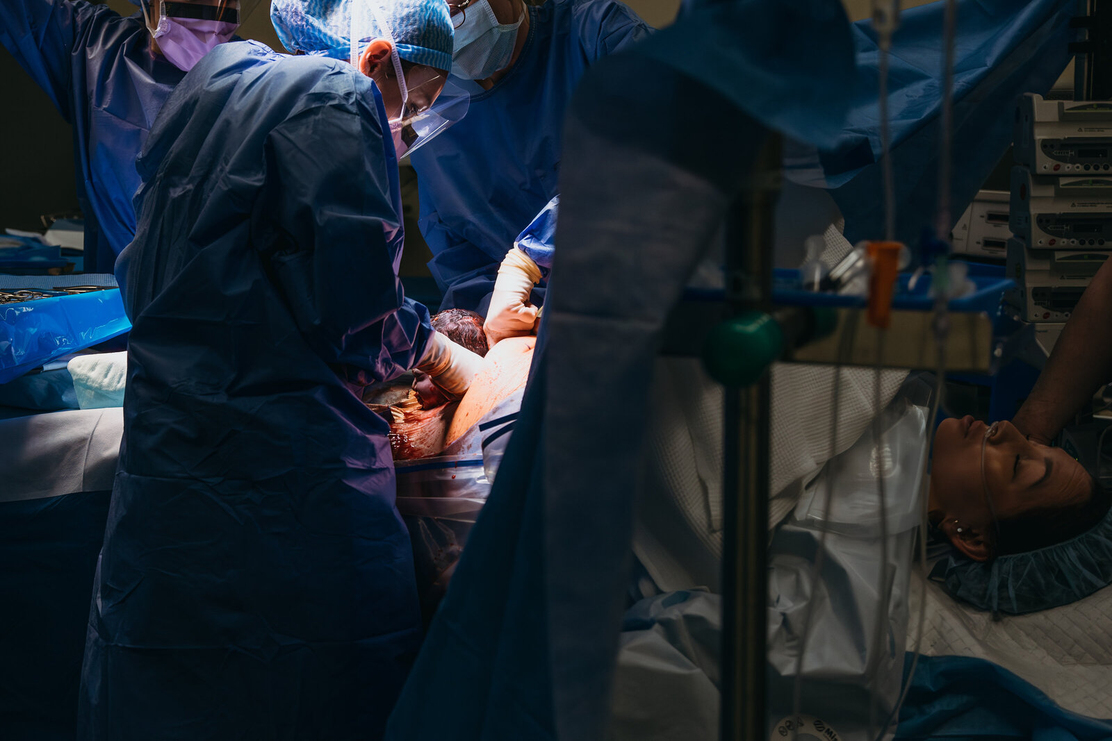 reportage photo accouchement thonon - accouchement a domicile - vanessa amiot photographe - cesarienne - reportage photo cesarienne