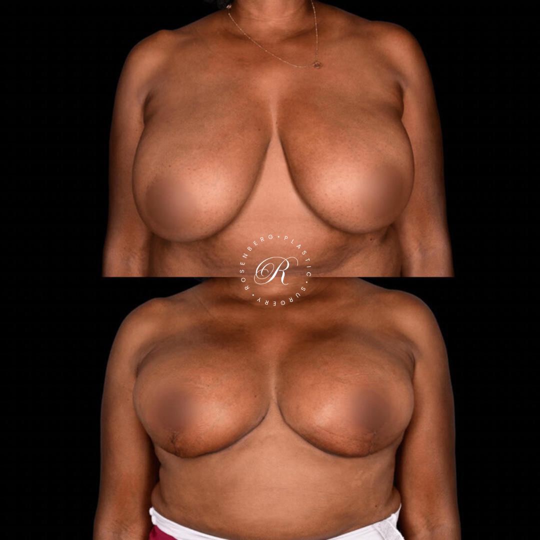 Copy of Template for Rosenberg Plastic Surgery B.zip - 26