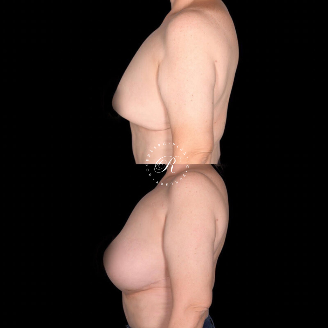 Copy of Copy of Template for Rosenberg Plastic Surgery B.png