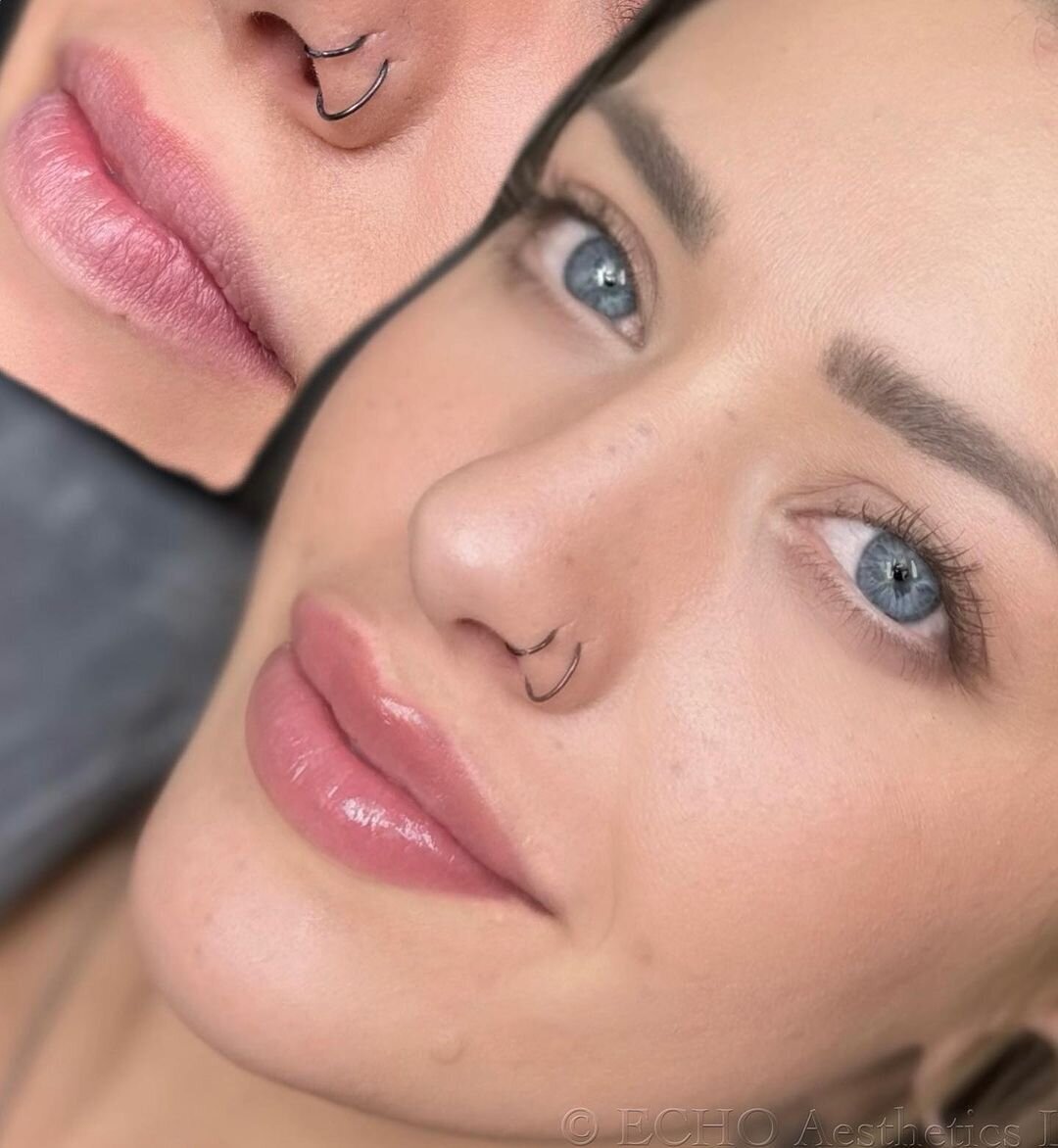 Liner 3