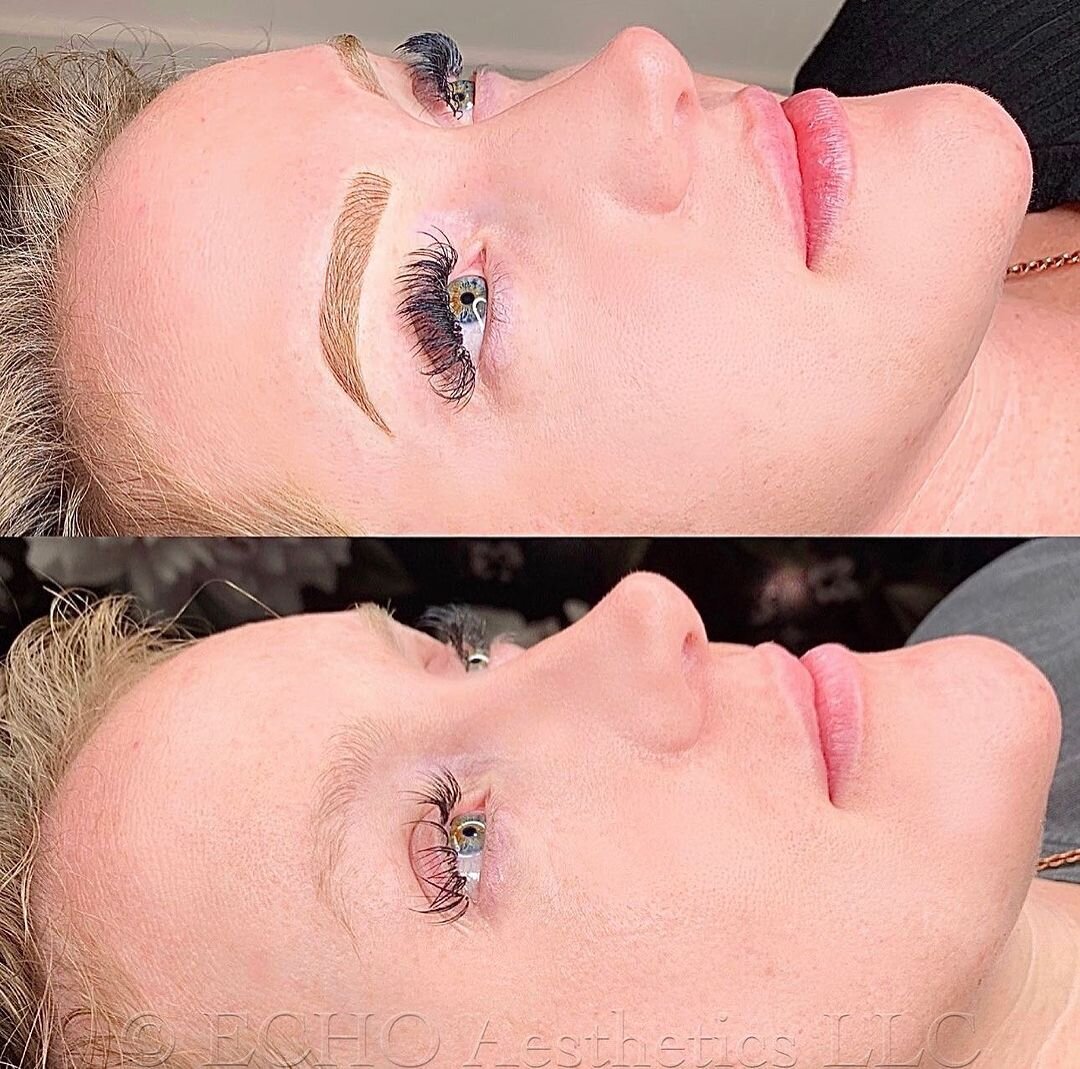 Eyebrow Microblading