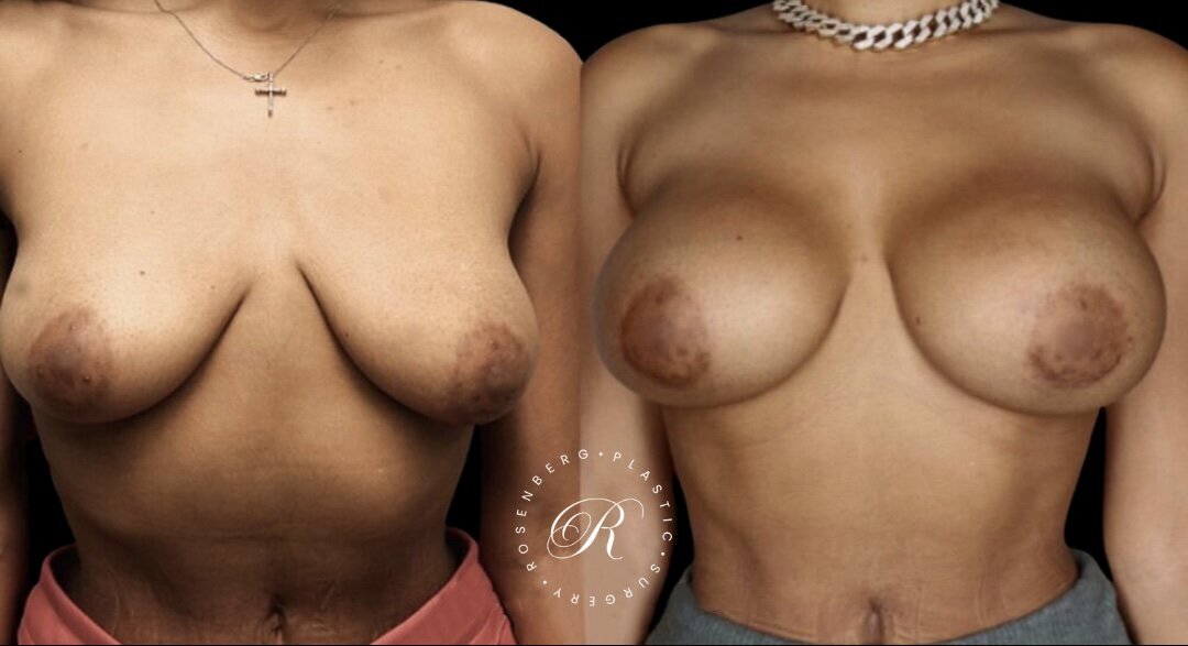 Copy of Copy of Template for Rosenberg Plastic Surgery B 3.png